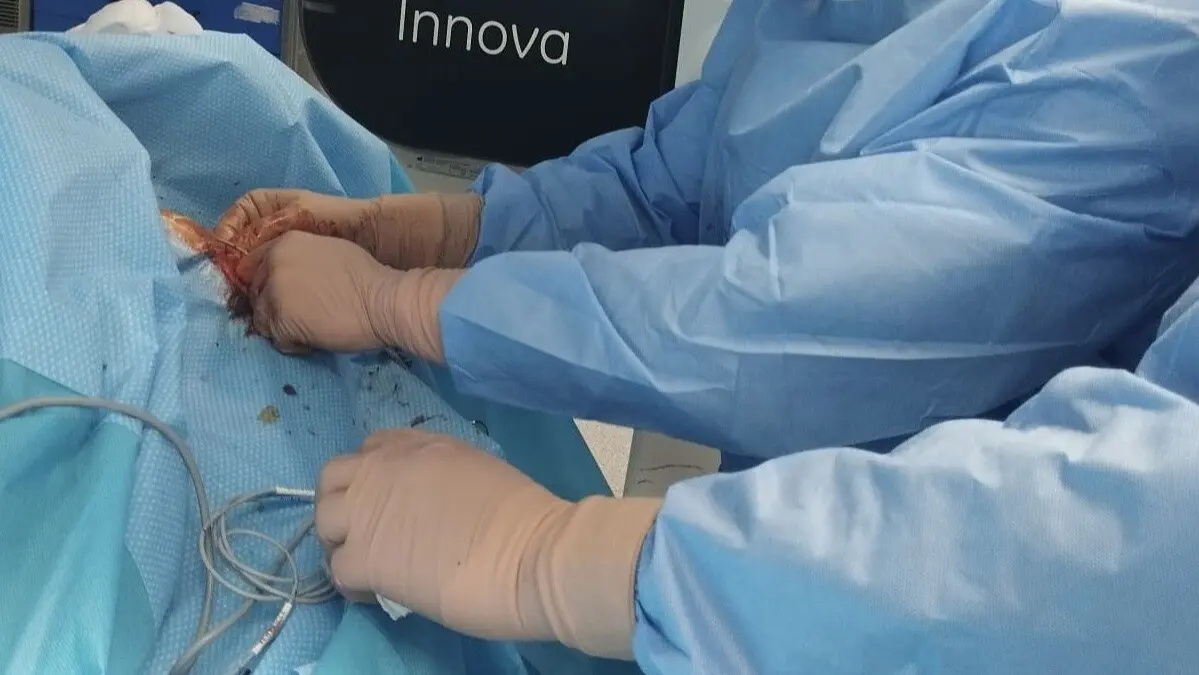 Nueva t&eacute;cnica empleada en el Hospital Punta Europa, Algeciras