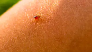 En la mayor&iacute;a de los casos, la picadura del mosquito no debe derivar en problemas graves